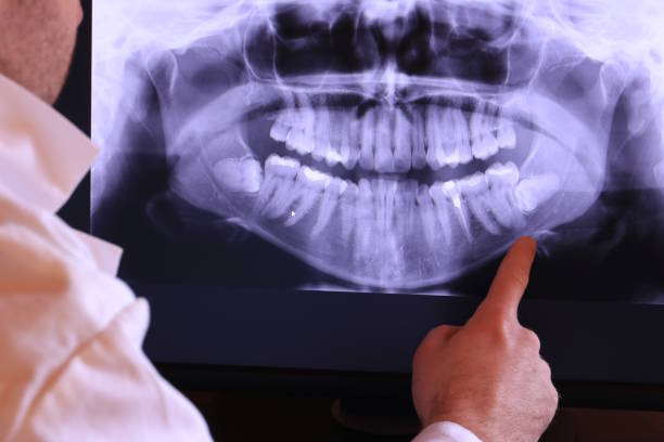 Best Emergency Dental Services for Seniors in New Albany, OH