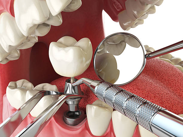 Mobile Emergency Dentist